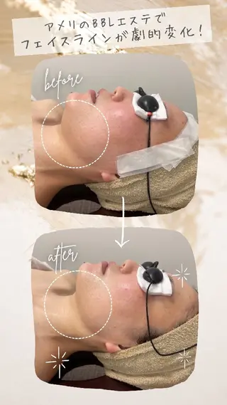 サロンアメリ高知駅前店所属・脱毛専門サロンアメリ 高知駅前店のエステ・リラクイメージ