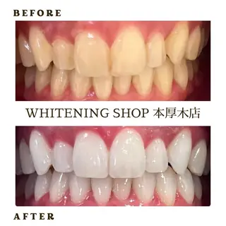 メンズ ホワイトニング ショップ本厚木のその他イメージ