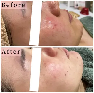 ハーブピーリング専門 muro.のエステ・リラクイメージ