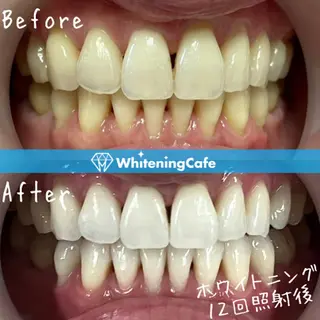 ホワイトニングカフェ徳島沖浜店所属・ホワイトニングカフェ 徳島沖浜店のエステ・リラクイメージ