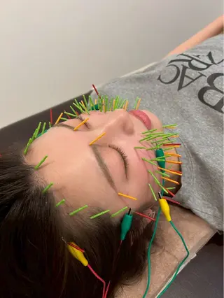 美容鍼灸Solana所属・肌質改善×美容鍼 ゆいのエステ・リラクイメージ