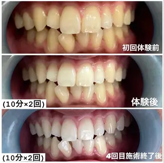 ホワイトニング専門店 Hi-Whiteのその他イメージ