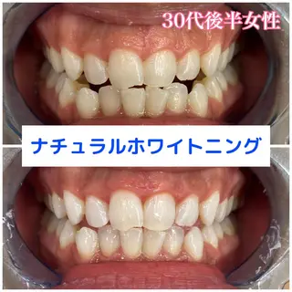 Platinum Beauty 四条烏丸店所属・吉田亮利 ホワイトニング専門店のその他イメージ