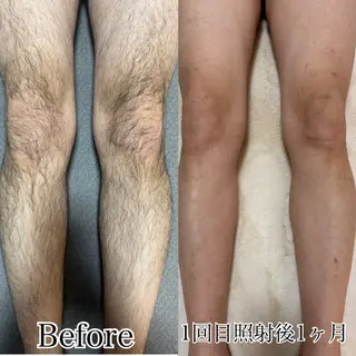 メンズ SHELLY 池本知香のエステ・リラクイメージ