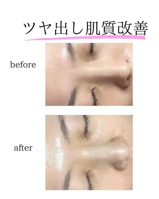 Salon【yuzu.】所属・🍊肌管理×美眉 【yuzu.】の眉毛・アイブロウイメージ