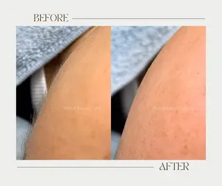 艶肌ワックス ALLY.のエステ・リラクイメージ