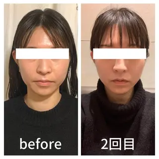 小顔サロン AMYONのエステ・リラクイメージ