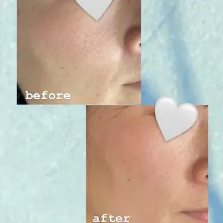 メナードフェイシャルサロン鳳北町所属・鳳北町 森田はるかのエステ・リラクイメージ