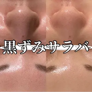 中目黒ハーブピーリン グ🌿ララピールのエステ・リラクイメージ