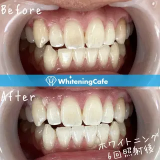 ホワイトニングカフェ徳島沖浜店所属・ホワイトニングカフェ 徳島沖浜店のエステ・リラクイメージ