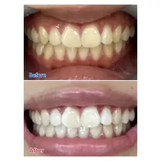 M渋谷店所属・Ｍ渋谷 ホワイトニングのエステ・リラクイメージ