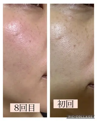 美肌専門salon クオレのエステ・リラクイメージ