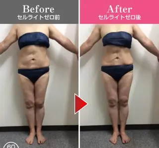 温活beautyサロンNeroli所属・切らない脂肪吸引🔥 Neroliまりこのエステ・リラクイメージ