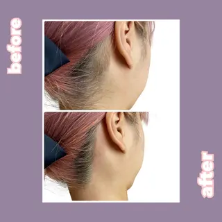 【痩身・脱毛サロン】 REBISKIN🌱のエステ・リラクイメージ