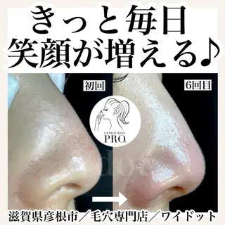 Ydot. 池内 友架のエステ・リラクイメージ