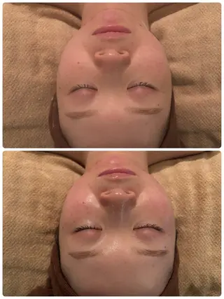 痩身/フェイシャル 💓KOUMA💓のエステ・リラクイメージ