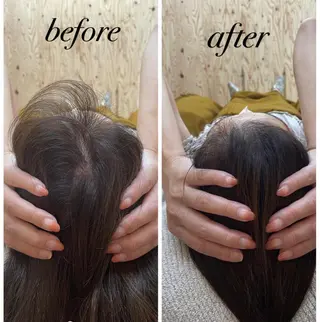 ate'所属・個室ドライヘッドスパ 🍃moriのエステ・リラクイメージ