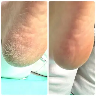 東京巻き爪アカデミー所属・東京巻き爪 アカデミーのエステ・リラクイメージ