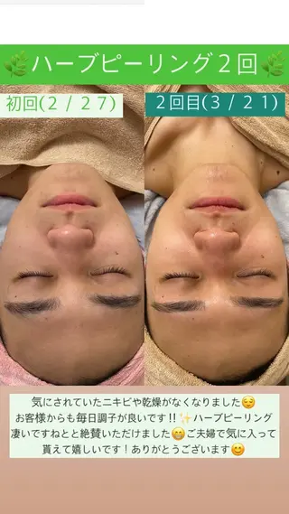 メンズ Salon de Lino 御器所のエステ・リラクイメージ