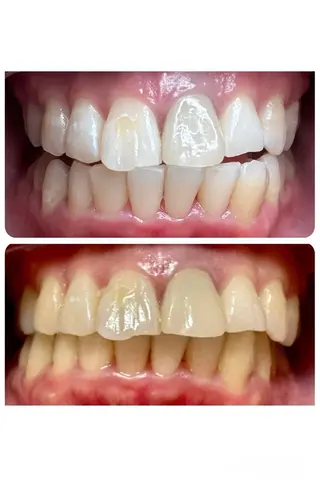 HAKU Aのその他イメージ