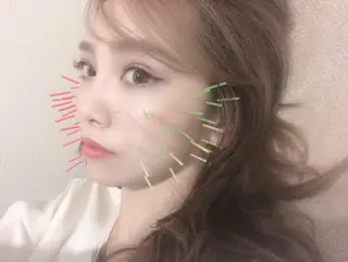 鍼灸整骨院Refine所属・鍼灸 Refineのその他イメージ