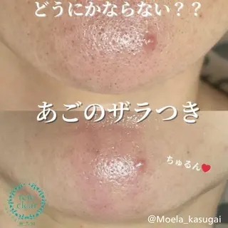 若山 遙子のエステ・リラクイメージ