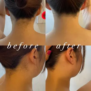 うなじ脱毛/美肌脱毛 LABELのエステ・リラクイメージ