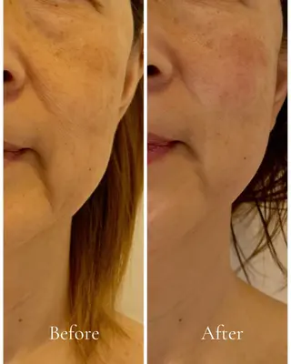 Lani Moon所属・⟡ 京都 小顔  ⊹ Lani Moonのエステ・リラクイメージ