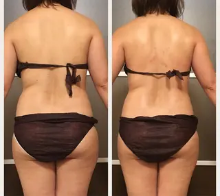 ミディアム カラー パーマ ヘアアレンジ メンズ キッズ ネイル マツエク・マツパ アニメ,Vオタク× 即効痩せエステサロンのエステ・リラクイメージ