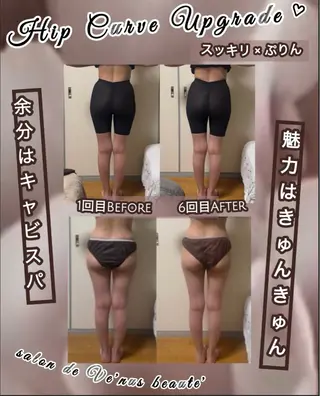 ヴィーナス ビューティーのエステ・リラクイメージ