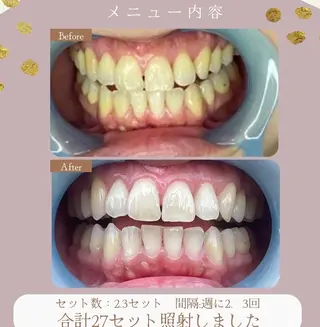 LAVISH nail salonのネイルデザイン