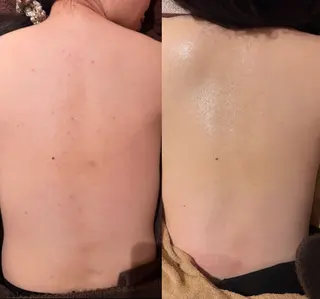 for woman所属・森 美優のエステ・リラクイメージ