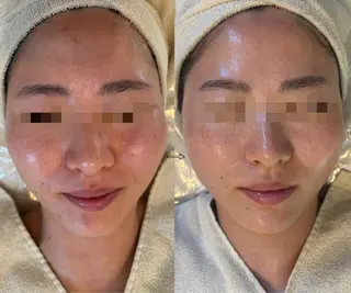 anthes /MIHOのエステ・リラクイメージ