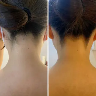 うなじ脱毛/美肌脱毛 LABELのエステ・リラクイメージ