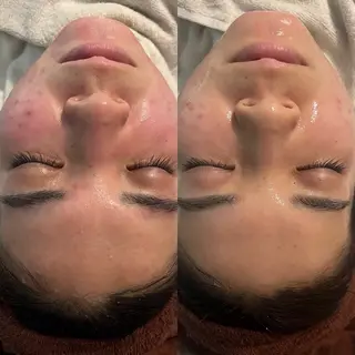 Belle 天王寺店所属・韓国肌管理Belle 天王寺のエステ・リラクイメージ