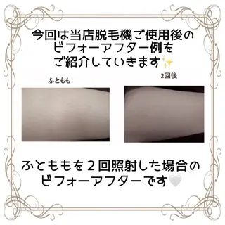 セルフエステサロンBATON所属・セルフエステサロン BATONのエステ・リラクイメージ