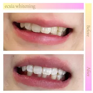 セルフホワイトニング エクシア六本木店のその他イメージ