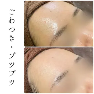 ハーブピーリング専門 BIOEL横浜のエステ・リラクイメージ