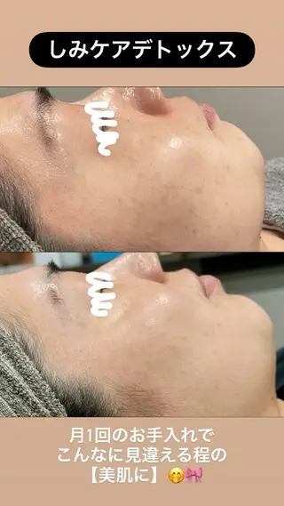 LiZA エステティックサロンのエステ・リラクイメージ