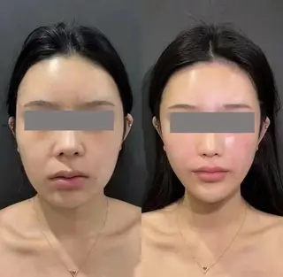 ショート aliaハイフ&水光ジェットサロン所属・aliaハーブ水光店 エステティシャン募集のエステ・リラクイメージ