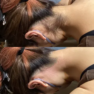 うなじラボ(UNAJI LABO)所属・池袋脱毛 さとうのエステ・リラクイメージ