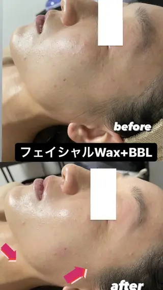 セミロング パーマ メンズ ヘアアレンジ ネイル マツエク・マツパ Epina 千葉店 【エピナ】のエステ・リラクイメージ