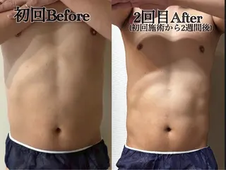 メンズ 六本木/似合わせ眉毛 andＳ🍀Yuriのエステ・リラクイメージ