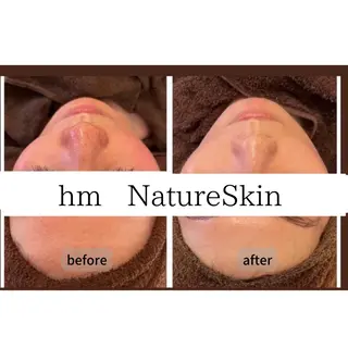 hm NATURESKINのエステ・リラクイメージ