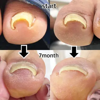 ネイル atelier alle.のネイルデザイン