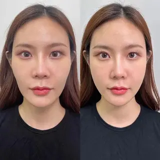 ネイル aliaハイフ&水光ジェットサロン所属・aliaハーブ水光店 エステティシャン募集のエステ・リラクイメージ