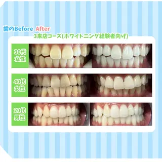 セルフホワイトニング Dolce水戸店のその他イメージ