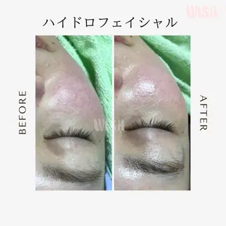 WISH 美肌脱毛のプロ！須藤のエステ・リラクイメージ