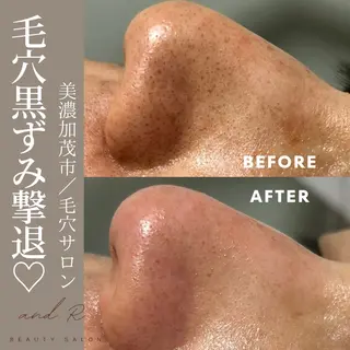 and R 男女 脱毛、毛穴サロンのエステ・リラクイメージ