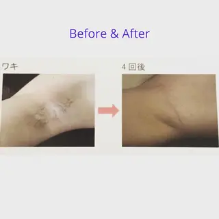 A myのエステ・リラクイメージ